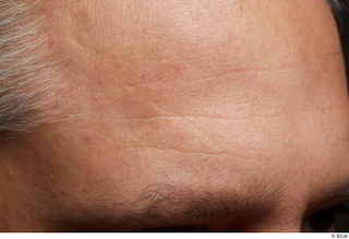  HD Face skin references Lukas Mina eyebrow forehead skin pores skin texture wrinkles 0001.jpg